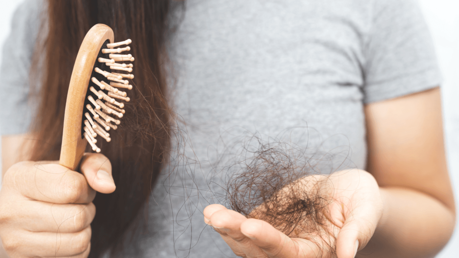 Queda de cabelo Queda de cabelo